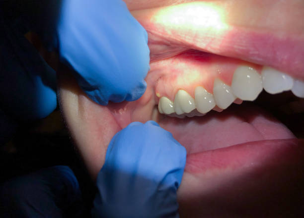 Best Tooth Pain Emergency Relief  in Mount Sterling, IL
